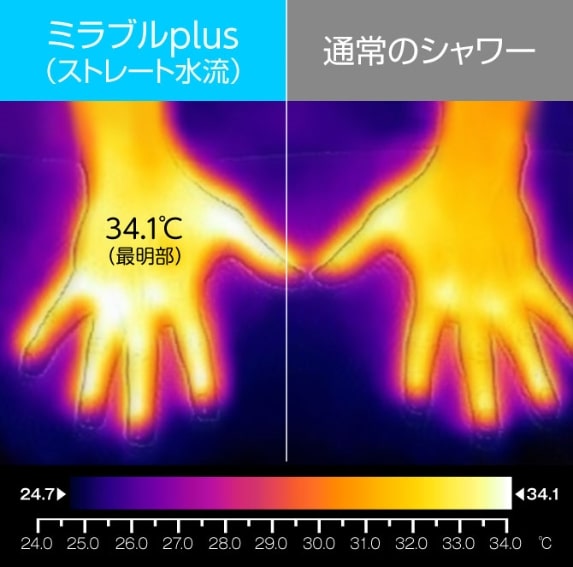 肌表面温度差のサーモグラフィの画像